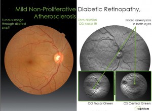 EasyScan Retinal Image (6)