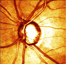 Heidelberg Retinal Photo (9)